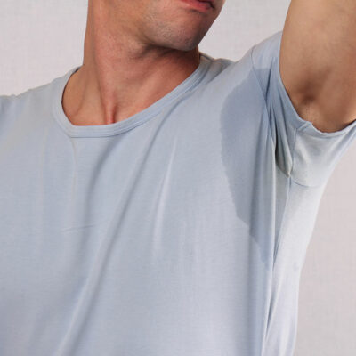 6 Lifestyle Changes to Manage Hyperhidrosis