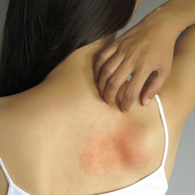 Effective Lifestyle Tips to Manage Asthma and Allergies