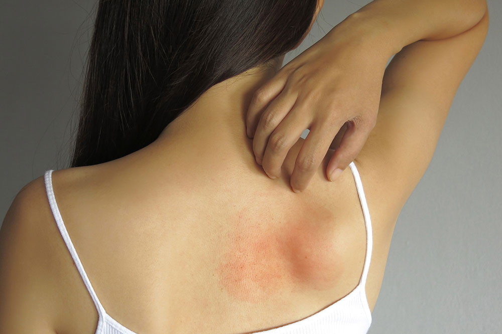 Effective Lifestyle Tips to Manage Asthma and Allergies