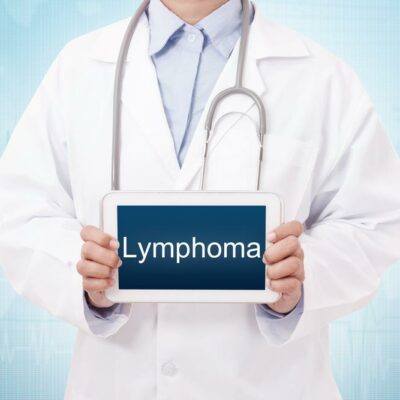 Lymphoma: Know About These Top Treatment Methods